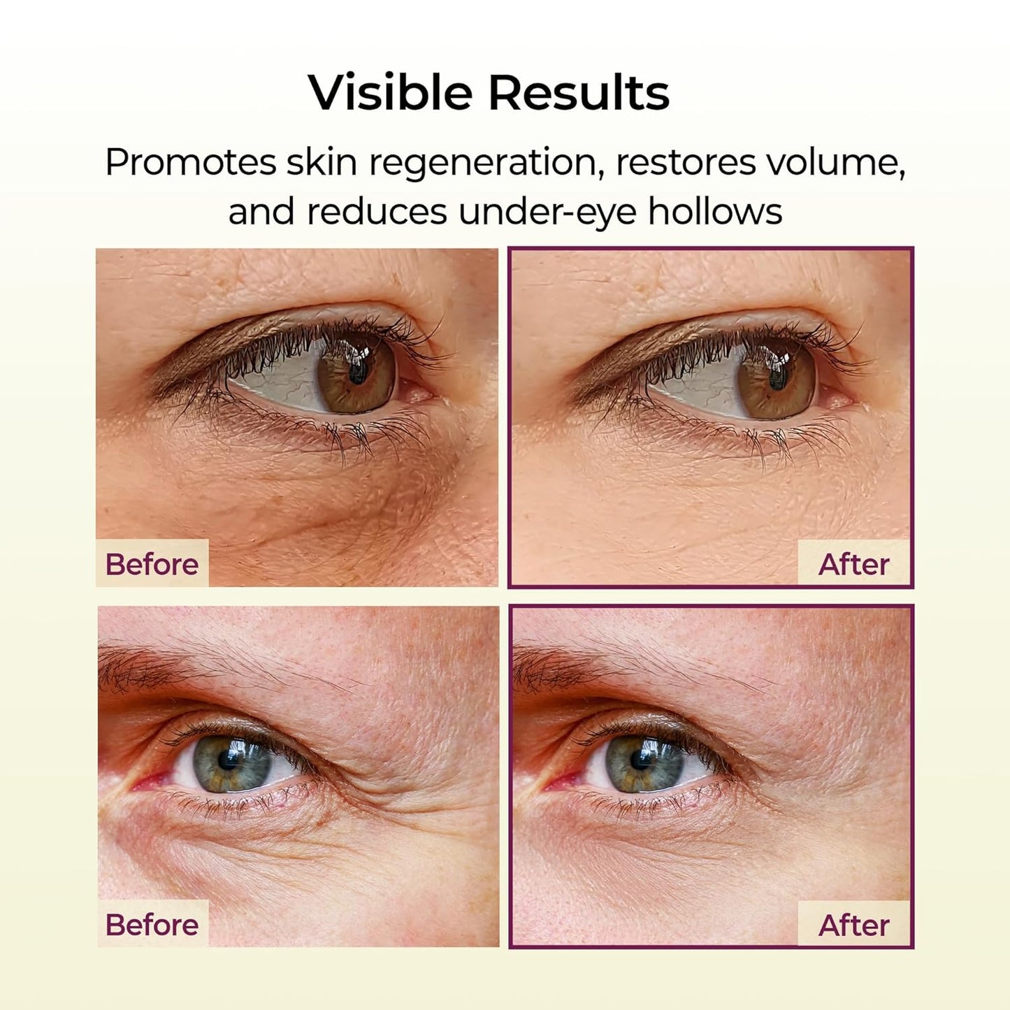 Últimas 3 horas: 60% de desconto 🔥 Kit Collagen Boost de 5 passos (presente): Bálsamo de colagénio com cálcio para firmeza e cuidado dos poros.