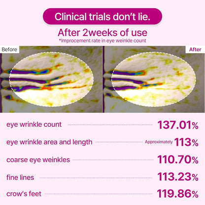 🔥 Collagen Revitalizing 5-Step Set, minimizes pores, includes a calcium-rich collagen cream